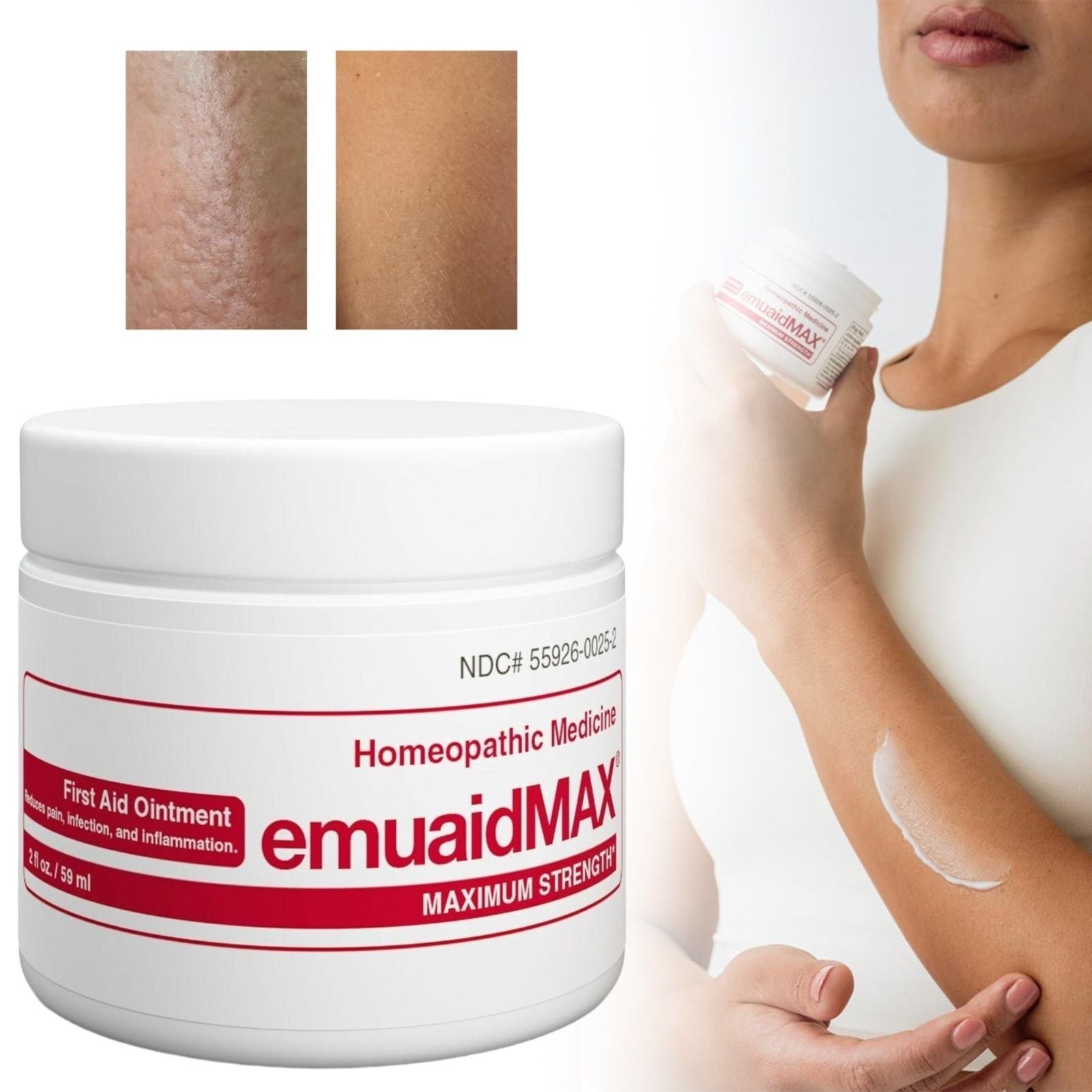 Multi-Purpose Ointment